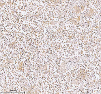 Anti-PLBD2 Antibody