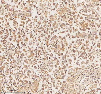 Anti-PLBD2 Antibody
