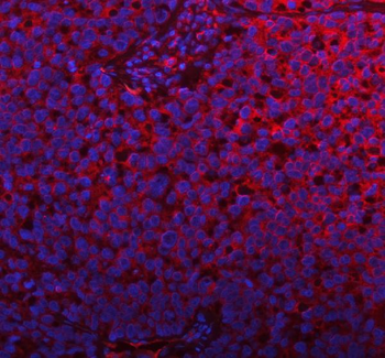 Anti-PLBD2 Antibody