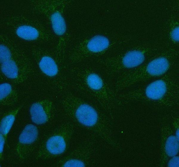 Anti-PLBD2 Antibody
