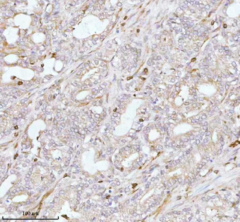 Anti-PLBD2 Antibody