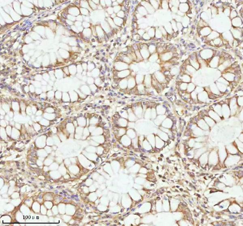 Anti-PLBD2 Antibody