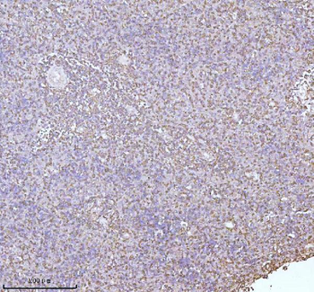 Anti-PLBD2 Antibody