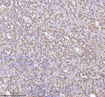 Anti-PLBD2 Antibody