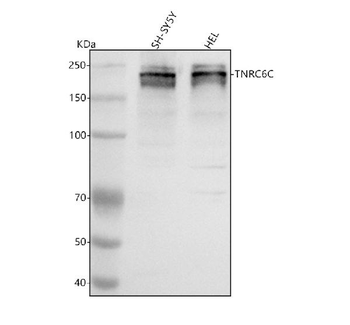 TNRC6C Antibody
