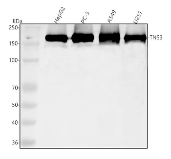 Anti-TNS3 Antibody