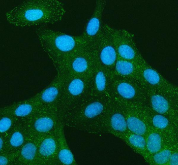 Anti-TNS3 Antibody
