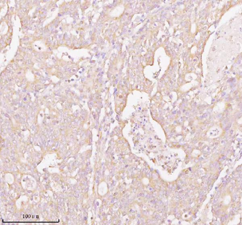 Anti-TNS3 Antibody
