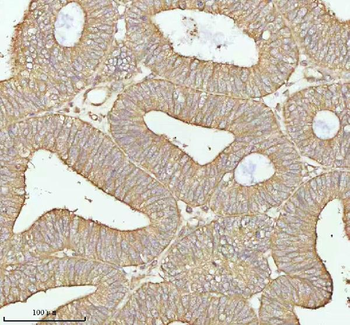 Anti-TNS3 Antibody