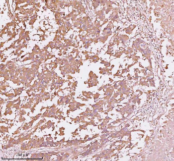 Anti-TNS3 Antibody