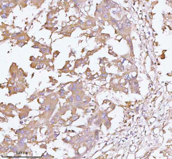 Anti-TNS3 Antibody