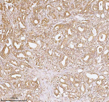 Anti-TNS3 Antibody