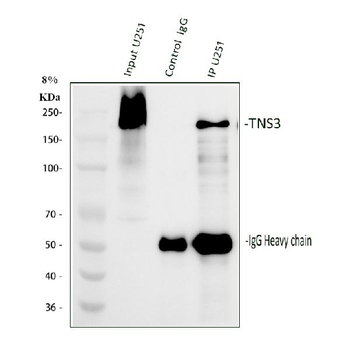Anti-TNS3 Antibody