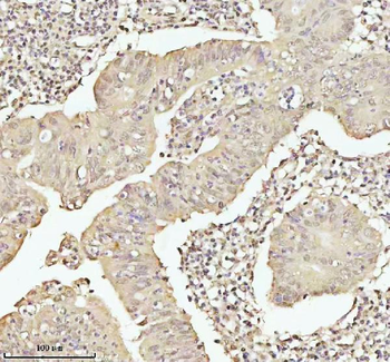 Anti-PITHD1 Antibody