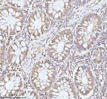 Anti-PITHD1 Antibody