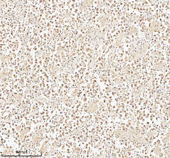 Anti-PITHD1 Antibody