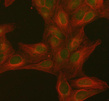Anti-PITHD1 Antibody