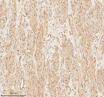Anti-PITHD1 Antibody