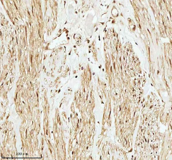 Anti-PITHD1 Antibody