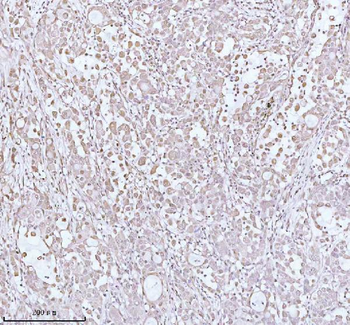 Anti-PITHD1 Antibody