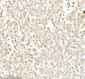 Anti-PITHD1 Antibody