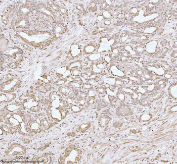 Anti-PITHD1 Antibody