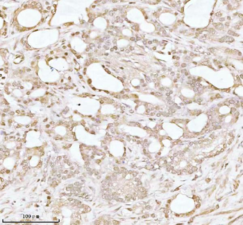 Anti-PITHD1 Antibody