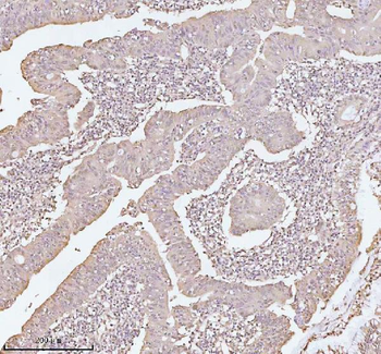 Anti-PITHD1 Antibody