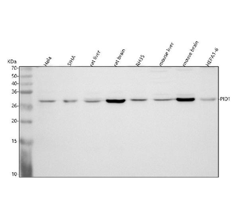 Anti-PID1 Antibody