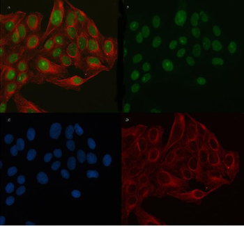 Anti-PERM1 Antibody