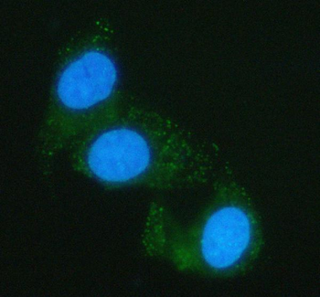 Anti-PGM2 Antibody