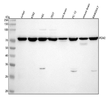 Anti-PGM2 Antibody