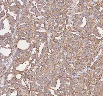 Anti-SLC7A7 Antibody