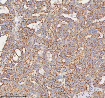 Anti-SLC7A7 Antibody