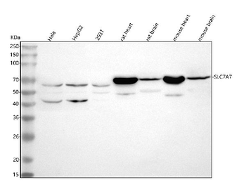 Anti-SLC7A7 Antibody