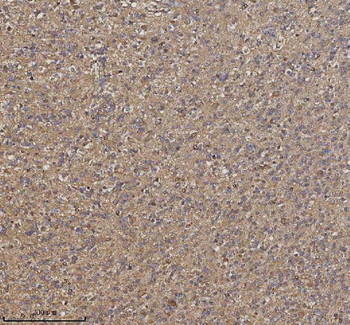 Anti-TRIM2 Antibody