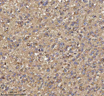 Anti-TRIM2 Antibody