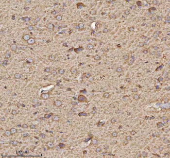 Anti-TRIM2 Antibody