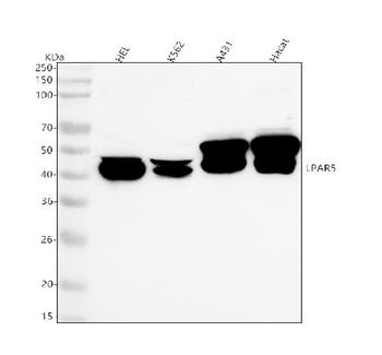 Anti-LPAR5 Antibody