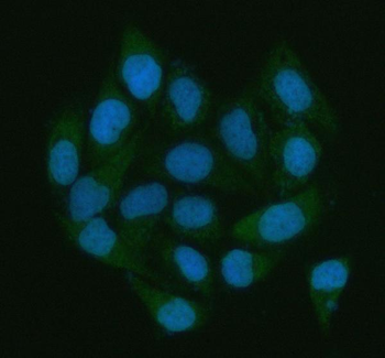 Anti-LGALS3BP Antibody