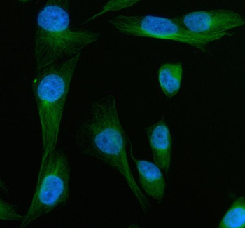 Anti-MYOT Antibody