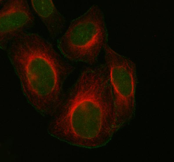 Anti-FOXM1 Antibody