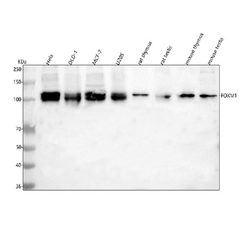 Anti-FOXM1 Antibody