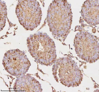 Anti-MICALL1 Antibody