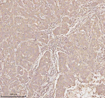 Anti-MICALL1 Antibody
