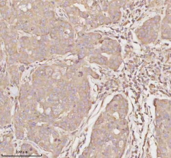 Anti-MICALL1 Antibody