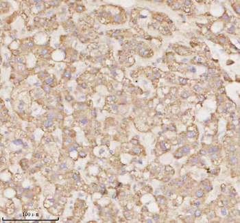 Anti-MICALL1 Antibody