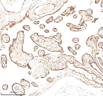 Anti-MICALL1 Antibody