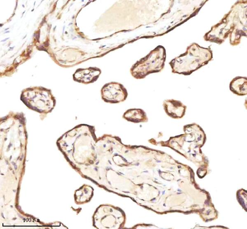 Anti-MICALL1 Antibody