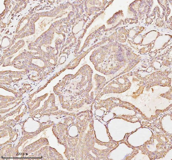 Anti-MICALL1 Antibody